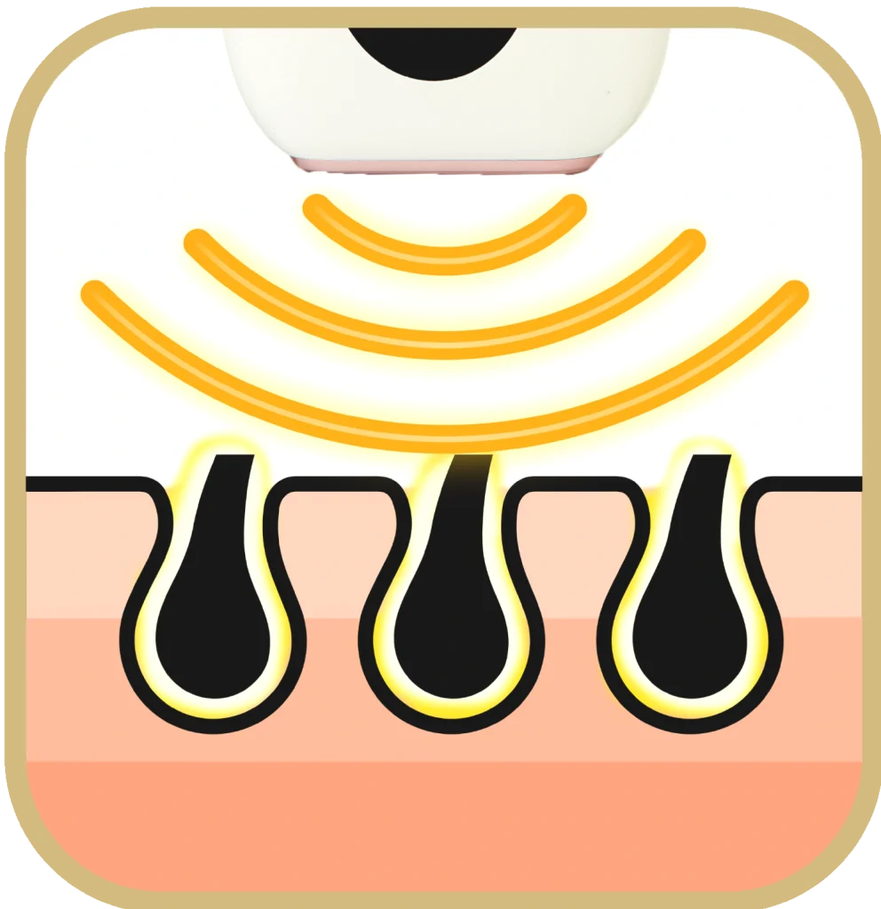 1-3week_eroskare_IPL_penetration ErosKare依洛絲脈衝光除毛機 毛髮變細變慢效果圖 持續使用達成長效除毛