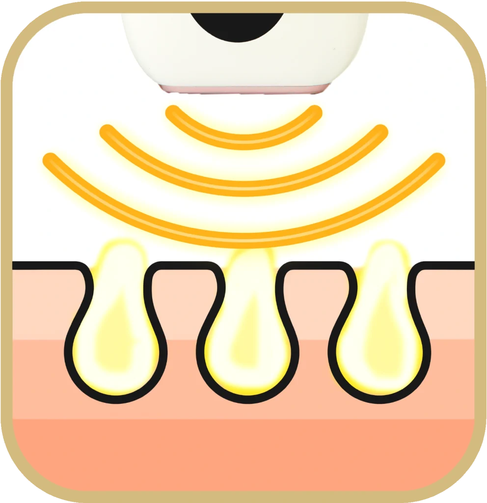 8week_ eroskare_IPL_hair_reduction ErosKare依洛絲脈衝光除毛機 IPL深入毛囊 溫和安全除毛原理示意